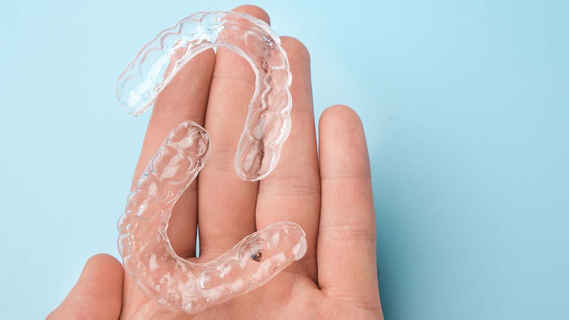 Clear Aligners image