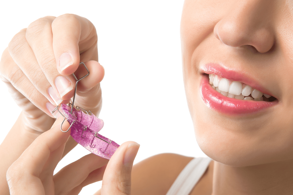 How Long Should You Wear Your Retainer?