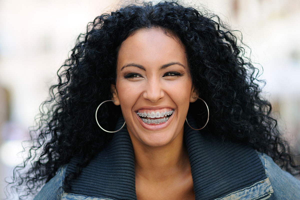 How Quickly Can Braces Straighten Adult Teeth? Legacy Smiles