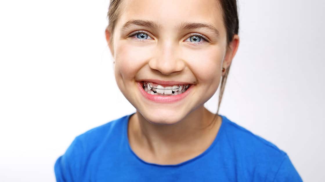 Interceptive Orthodontics