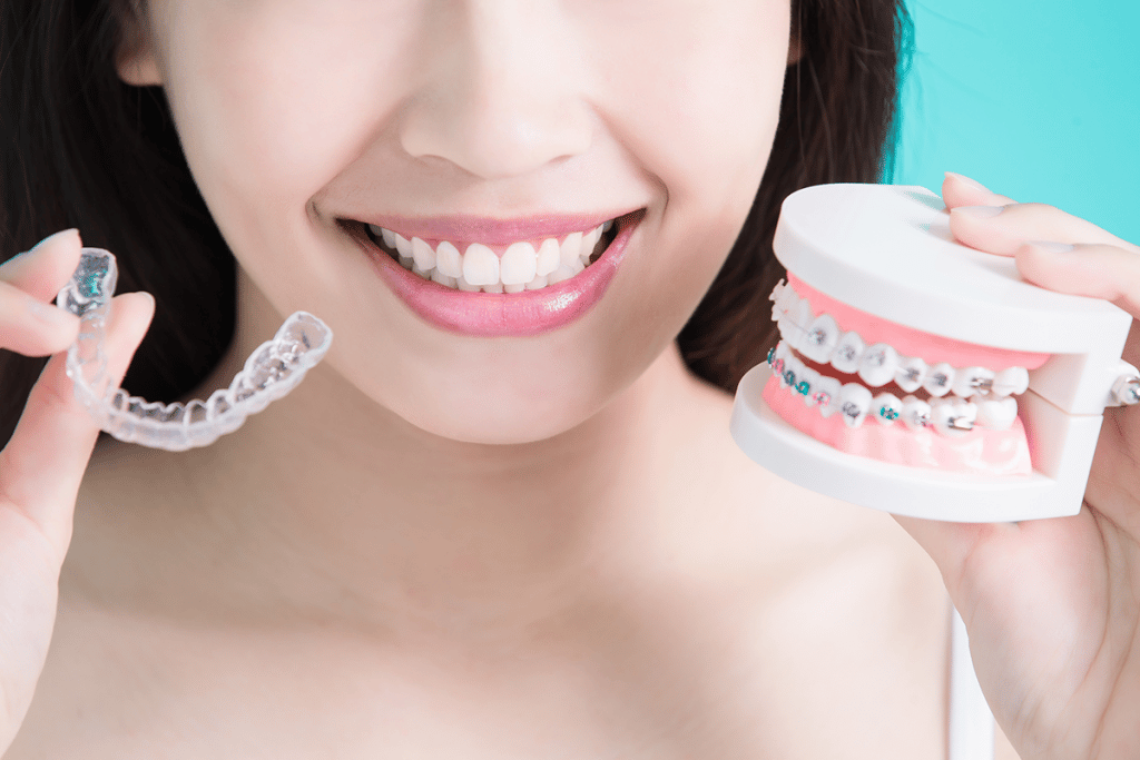 Keeping Teeth Straight After Adult Braces